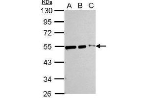 WB Image Sample (whole cell lysate) A: 293T 20ug B: 293T 10ug C: 293T 5ug 10% SDS PAGE antibody diluted at 1:10000