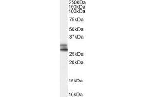 Image no. 1 for anti-Catechol-O-Methyltransferase (COMT) (N-Term) antibody (ABIN185328)