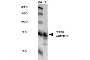 Image no. 2 for anti-Protein Tyrosine Phosphatase Receptor Type F (PTPRF) (AA 1315-1607) antibody (ABIN1740981)