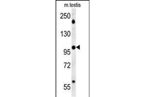 Image no. 2 for anti-WD Repeat Domain 11 (WDR11) (AA 544-572) antibody (ABIN5535764)