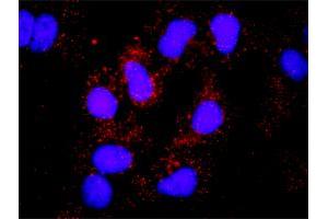 Image no. 2 for anti-Hemopoietic Cell Kinase (HCK) (AA 1-505) antibody (ABIN516368)