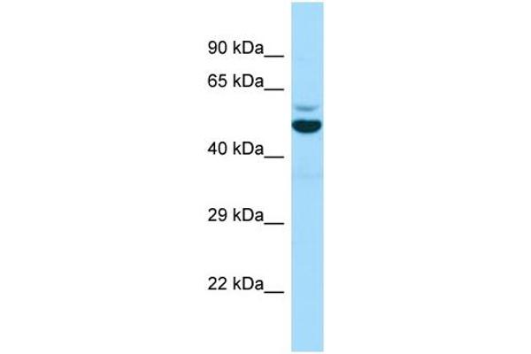 anti-Enhancer of mRNA Decapping 3 (EDC3) (Middle Region) antibody