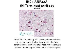 Image no. 3 for anti-Acidic (Leucine-Rich) Nuclear phosphoprotein 32 Family, Member A (ANP32A) antibody (ABIN1731809)