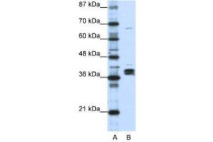 Image no. 4 for anti-Heterogeneous Nuclear Ribonucleoprotein D-Like (HNRPDL) (Middle Region) antibody (ABIN2778937)