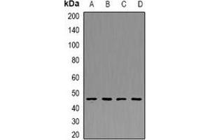 Image no. 3 for anti-Pyruvate Dehydrogenase Kinase, Isozyme 4 (PDK4) antibody (ABIN2966888)