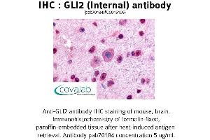 Image no. 2 for anti-GLI Family Zinc Finger 2 (GLI2) (Internal Region) antibody (ABIN1734718)