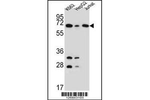 Western Blotting (WB) image for anti-Dihydrolipoyl Transacetylase (DLAT) antibody (ABIN2160605)