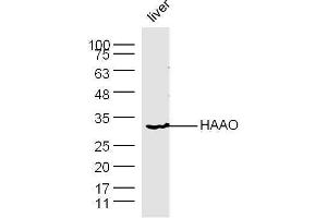 Image no. 1 for anti-3-hydroxyanthranilate 3,4-Dioxygenase (HAAO) (AA 101-200) antibody (ABIN1386562)