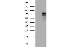 Image no. 6 for anti-Tumor Necrosis Factor Receptor Superfamily, Member 8 (TNFRSF8) (AA 19-379) antibody (ABIN1491085)