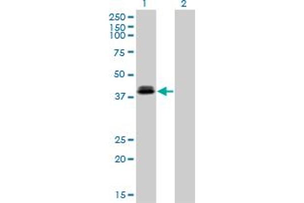 anti-Orthodenticle Homeobox 1 (OTX1) (AA 10-116) antibody