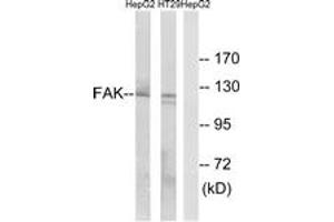 Image no. 1 for anti-PTK2 Protein tyrosine Kinase 2 (PTK2) (AA 363-412) antibody (ABIN1532612)
