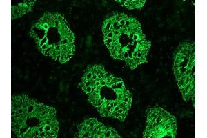 KRT8 antibody