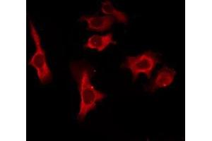 Image no. 1 for anti-CD83 (CD83) antibody (ABIN6260656)