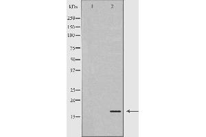 Image no. 3 for anti-Calmodulin 3 (Phosphorylase Kinase, Delta) (CALM3) antibody (ABIN6260413)
