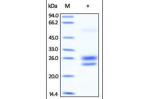 Image no. 1 for Interleukin 7 (IL7) (AA 26-177) (Active) protein (ABIN2181324)