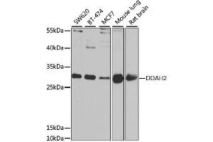 Image no. 1 for anti-Dimethylarginine Dimethylaminohydrolase 2 (DDAH2) antibody (ABIN6139457)