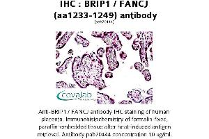Image no. 1 for anti-BRCA1 Interacting Protein C-terminal Helicase 1 (BRIP1) (AA 1233-1249) antibody (ABIN1732408)
