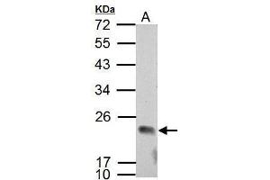 Image no. 1 for anti-Apolipoprotein B mRNA Editing Enzyme, Catalytic Polypeptide-Like 3C (APOBEC3C) (Center) antibody (ABIN2855306)