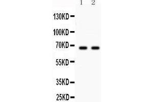 Image no. 3 for anti-Parkinson Protein 2, E3 Ubiquitin Protein Ligase (Parkin) (PARK2) (AA 23-416) antibody (ABIN3043896)