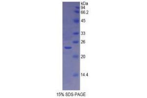 Image no. 1 for HLA Class II DR alpha (HLA-DRA) (AA 25-216) protein (His tag) (ABIN1878843)