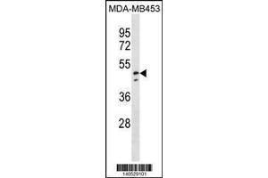 Image no. 1 for anti-NADH Dehydrogenase (Ubiquinone) Flavoprotein 1, 51kDa (NDUFV1) (AA 21-50), (N-Term) antibody (ABIN1881573)