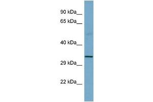 Image no. 1 for anti-Sarcoglycan, beta (43kDa Dystrophin-Associated Glycoprotein) (SGCB) (Middle Region) antibody (ABIN2781778)