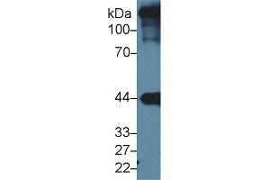 Image no. 4 for anti-Actin, Alpha, Cardiac Muscle 1 (ACTC1) (AA 156-368) antibody (ABIN1077733)
