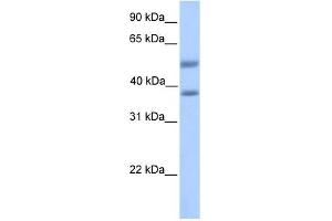 Image no. 1 for anti-ST6 (Alpha-N-Acetyl-Neuraminyl-2,3-beta-Galactosyl-1,3)-N-Acetylgalactosaminide alpha-2,6-Sialyltransferase 2 (ST6GALNAC2) (Middle Region) antibody (ABIN636026)