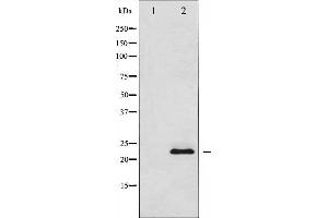 Image no. 1 for anti-Suppressor of Cytokine Signaling 2 (SOCS2) antibody (ABIN6265216)
