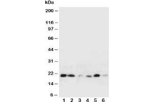 Image no. 3 for anti-Heat Shock 27kDa Protein 2 (HSPB2) (Middle Region) antibody (ABIN3031147)