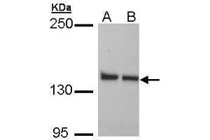 Image no. 3 for anti-Leucine-Rich PPR-Motif Containing (LRPPRC) (Internal Region) antibody (ABIN2856685)