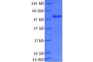 Image no. 1 for Zinc Finger, BED-Type Containing 1 (ZBED1) (AA 1-210), (partial) protein (GST tag) (ABIN618796)