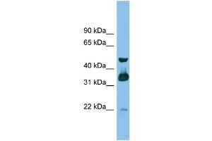Image no. 1 for anti-G protein beta subunit-like (GBL) (Middle Region) antibody (ABIN2787309)