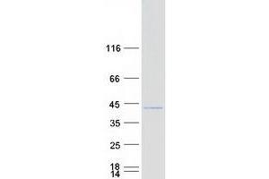 Image no. 1 for Male Enhanced Antigen 1 (MEA1) protein (Myc-DYKDDDDK Tag) (ABIN2725719)