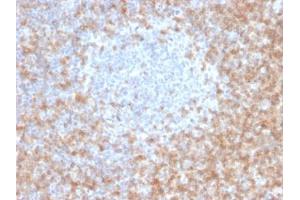 Image no. 2 for anti-CD5 (CD5) (AA 269-366), (Extracellular Domain) antibody (ABIN6383880)