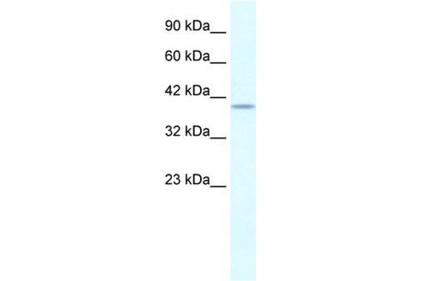 anti-phosphorylase Kinase, gamma 2 (Testis) (PHKG2) (N-Term) antibody