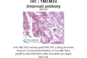 Image no. 2 for anti-Transmembrane Protein 33 (TMEM33) (Internal Region) antibody (ABIN1740155)