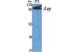 Image no. 2 for anti-FER Tyrosine Kinase (FER) (Ser376) antibody (ABIN3180618)