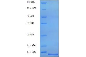 Image no. 1 for Serum Amyloid A (SAA) (AA 1-90), (full length) protein (His tag) (ABIN5713808)