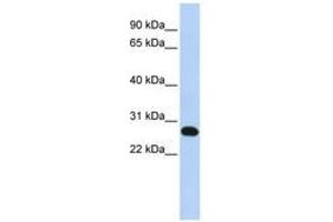Image no. 1 for anti-Family With Sequence Similarity 119A (FAM119A) (N-Term) antibody (ABIN6741187)