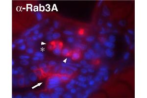 Image no. 2 for anti-RAB3A, Member RAS Oncogene Family (RAB3A) (AA 2-14) antibody (ABIN1742211)