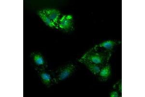 Image no. 2 for anti-alpha-Fetoprotein (AFP) (AA 19-397) antibody (ABIN2716008)