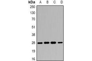 Image no. 2 for anti-14-3-3 alpha + beta (YWHAB) (full length) antibody (ABIN6006278)