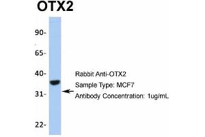 Image no. 5 for anti-Orthodenticle Homeobox 2 (OTX2) (N-Term) antibody (ABIN2779643)