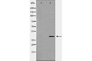 Image no. 2 for anti-Kallikrein 2 (KLK2) antibody (ABIN6266241)
