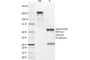 Image no. 4 for anti-Cyclin D1 (CCND1) antibody (ABIN6940486)