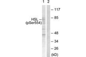 Western blot analysis of extracts from HeLa cells treated with Adriamycin 0.