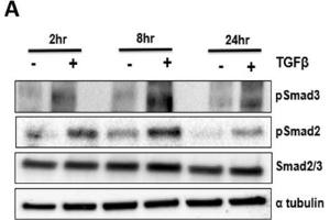 Image no. 6 for anti-alpha Tubulin (TUBA1) (C-Term) antibody (ABIN964563)