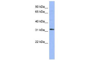 Image no. 1 for anti-T-Cell Leukemia Homeobox 1 (TLX1) (N-Term) antibody (ABIN2780689)