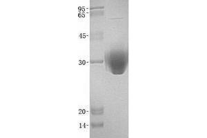 Image no. 1 for UL16 Binding Protein 2 (ULBP2) protein (ABIN2735004)